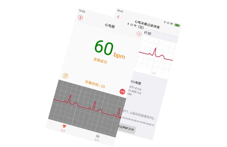 APP集成實(shí)例---心電芯片、心電手環(huán)芯片、可穿戴心電設(shè)備、智能監(jiān)護(hù)儀
